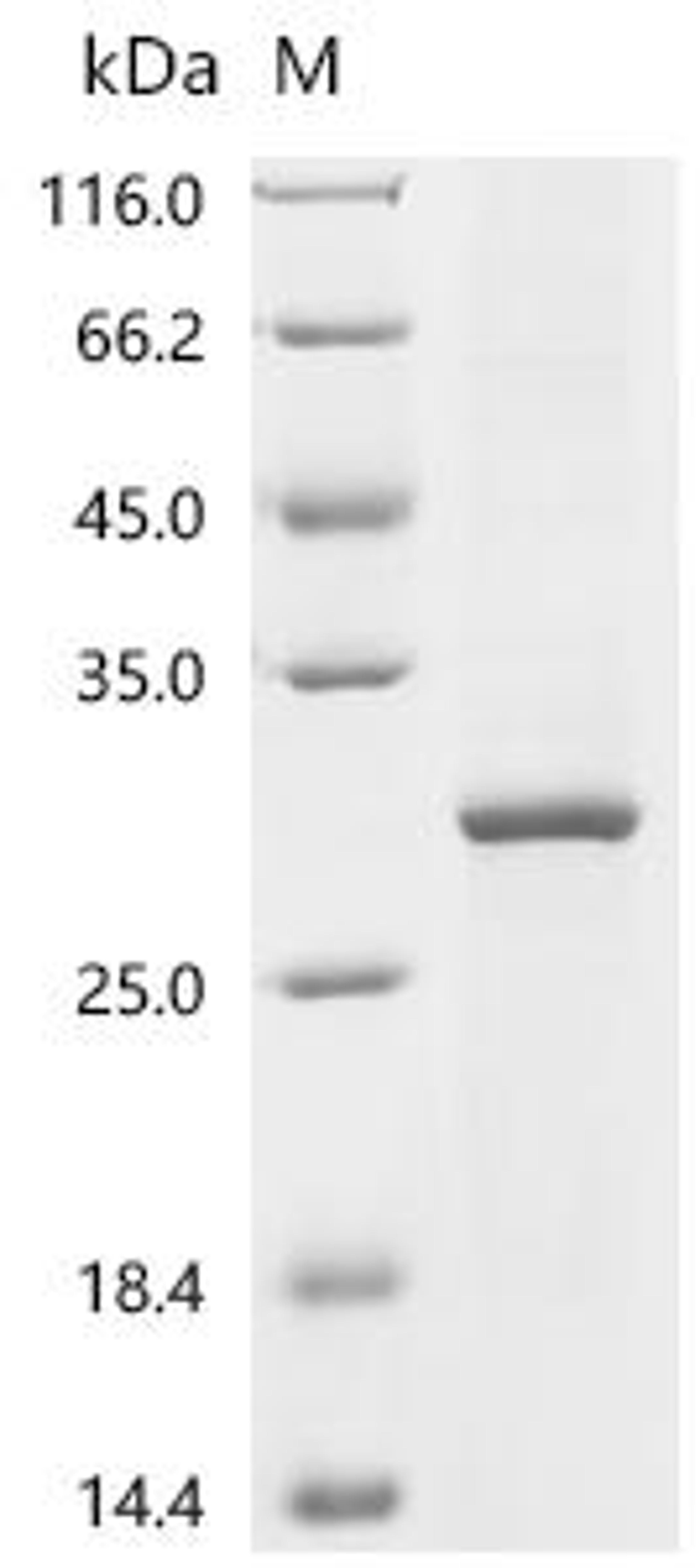(Tris-Glycine gel) Discontinuous SDS-PAGE (reduced) with 5% enrichment gel and 15% separation gel.
