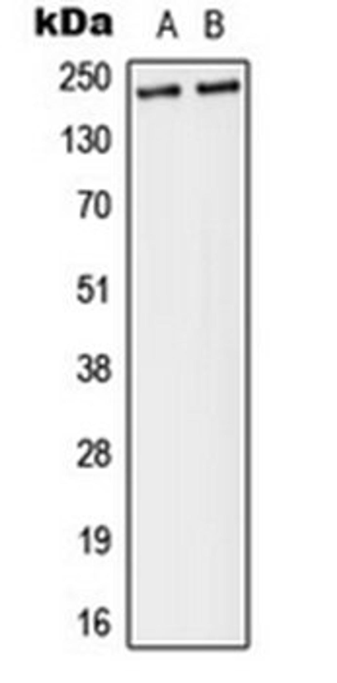 Western blot analysis of MDA-MB-231 (Lane 1), A431 (Lane 2) whole cell lysates using Separase (phospho-S801) antibody