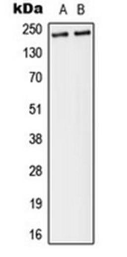 Western blot analysis of MDA-MB-231 (Lane 1), A431 (Lane 2) whole cell lysates using Separase (phospho-S801) antibody