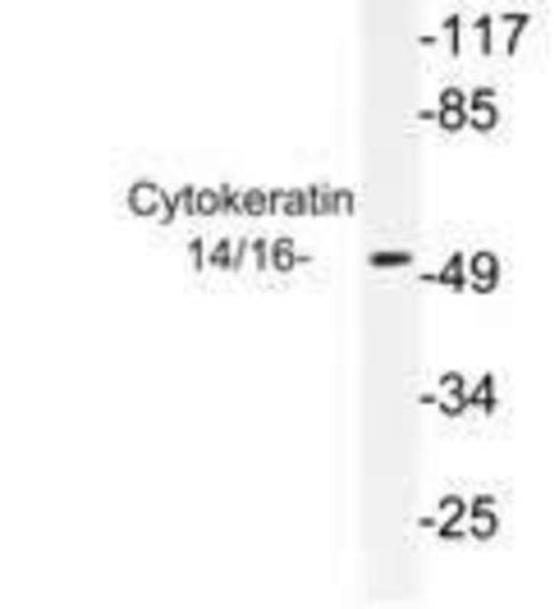 Western Blot: Cytokeratin 14/16 Antibody [NB100-91840] - Western  blot  (WB)  analysis of Keratin 14/16 (S5)  antibody in extracts from NIH/3T3 cells using NB100-91840.