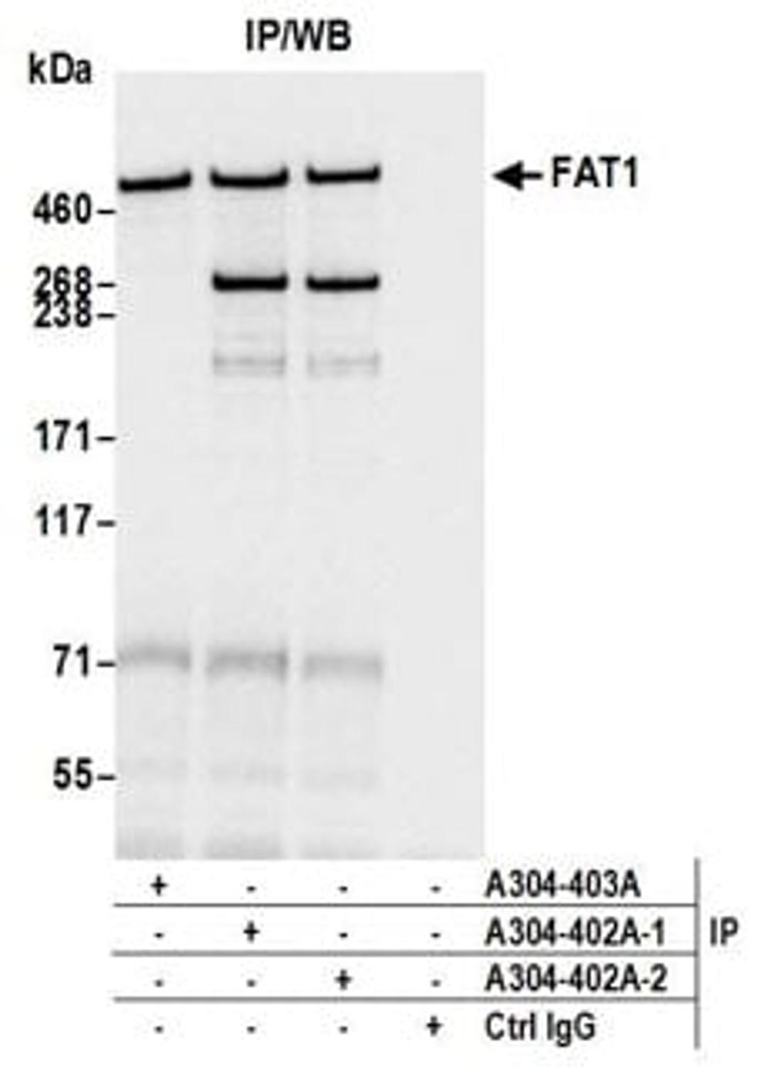 Detection of human FAT1 by western blot of immunoprecipitates.