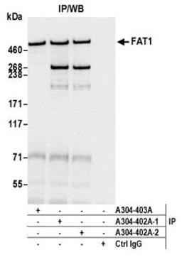 Detection of human FAT1 by western blot of immunoprecipitates.