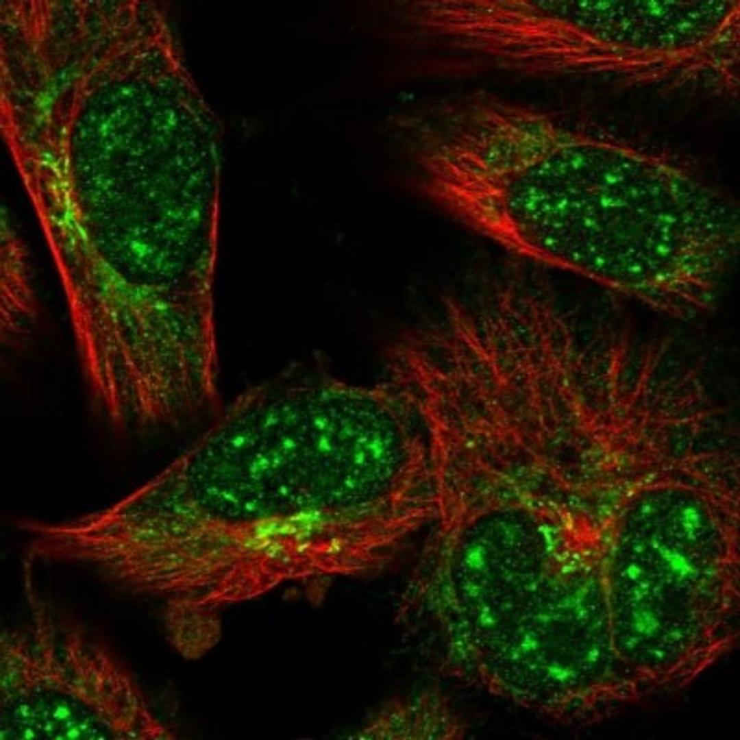 Immunocytochemistry/Immunofluorescence: IZUMO1 Antibody [NBP1-83086] - Staining of human cell line U-251 MG shows positivity in nucleus, cytoplasm & golgi apparatus.