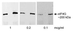 Western Blot: eIF4G1 Antibody [NB100-268] - Rat liver lysate [10K x g supernatant, ~50 ug (left) or 150 ug (right lane)] separated on 7.5% gel and transferred to PVDF membranes.Antibody: Affinity purified rabbit anti-eIF4G    used at the indicated concentrations.  Detection:Chemiluminescence.