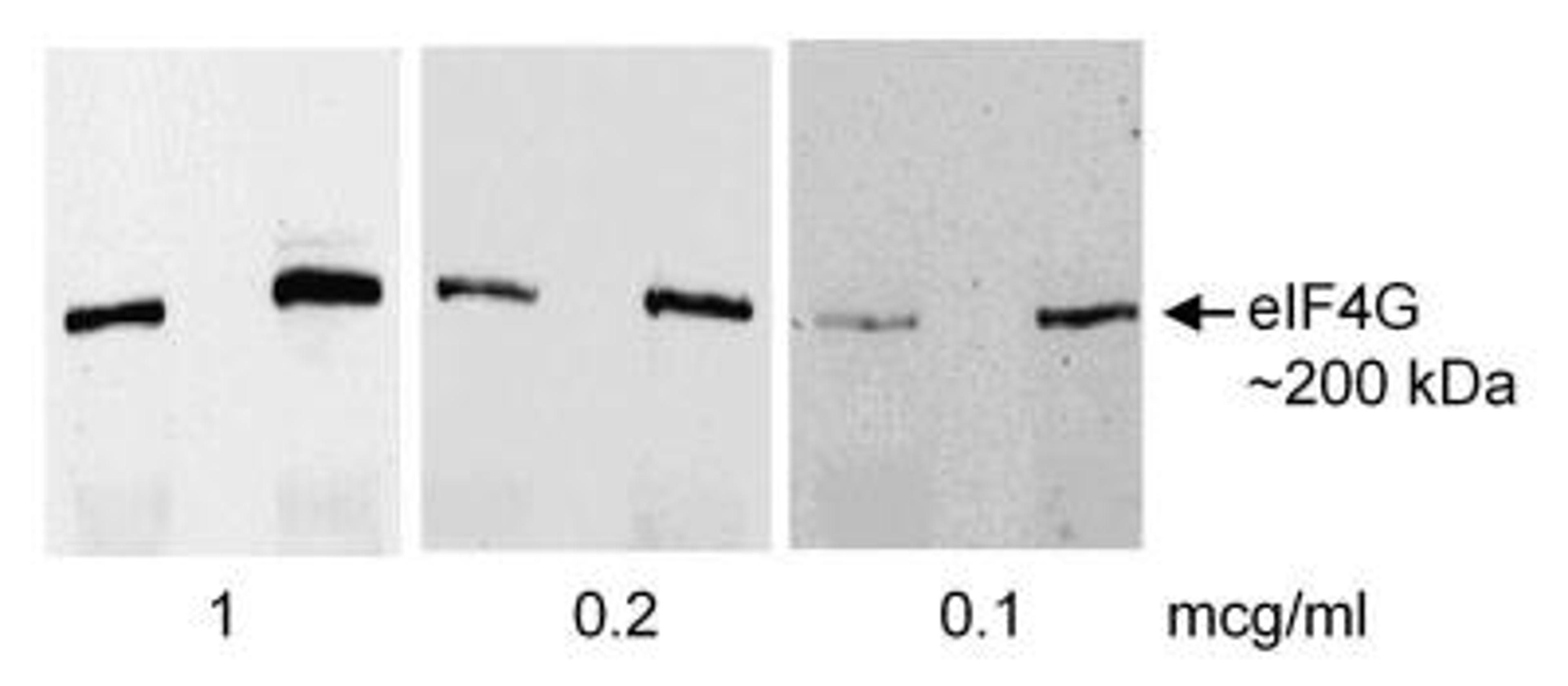 Western Blot: eIF4G1 Antibody [NB100-268] - Rat liver lysate [10K x g supernatant, ~50 ug (left) or 150 ug (right lane)] separated on 7.5% gel and transferred to PVDF membranes.Antibody: Affinity purified rabbit anti-eIF4G    used at the indicated concentrations.  Detection:Chemiluminescence.