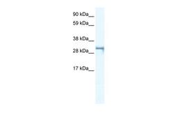 Antibody used in WB on Human Jurkat 0.2-1 ug/ml.