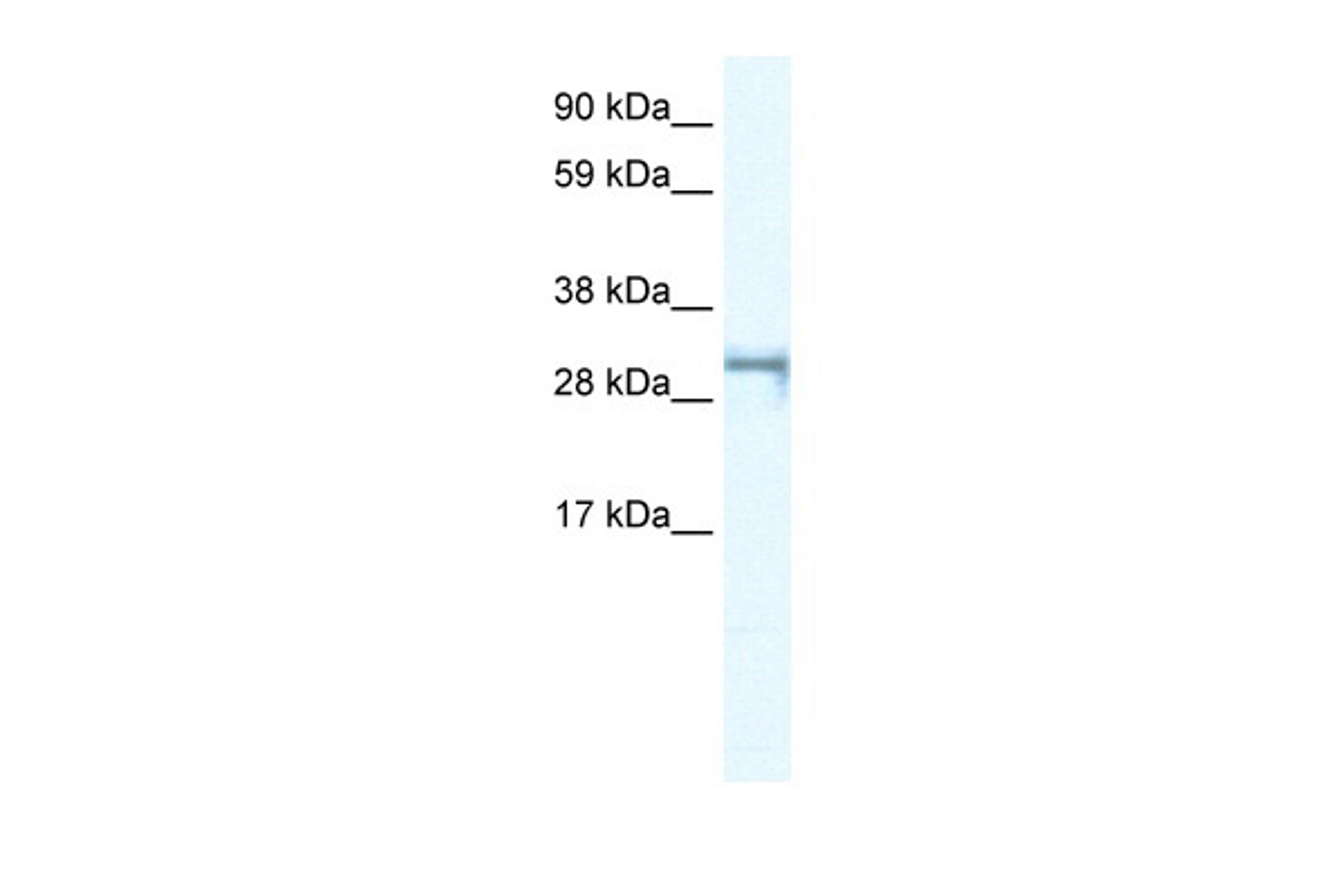 Antibody used in WB on Human Jurkat 0.2-1 ug/ml.