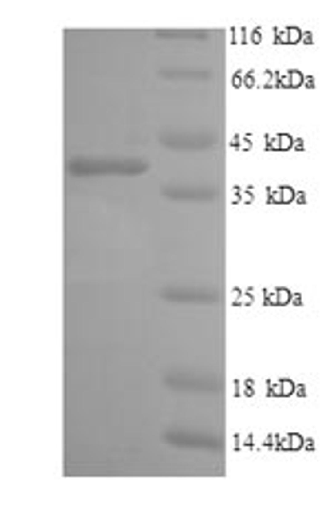 (Tris-Glycine gel) Discontinuous SDS-PAGE (reduced) with 5% enrichment gel and 15% separation gel.