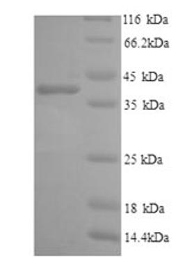 (Tris-Glycine gel) Discontinuous SDS-PAGE (reduced) with 5% enrichment gel and 15% separation gel.