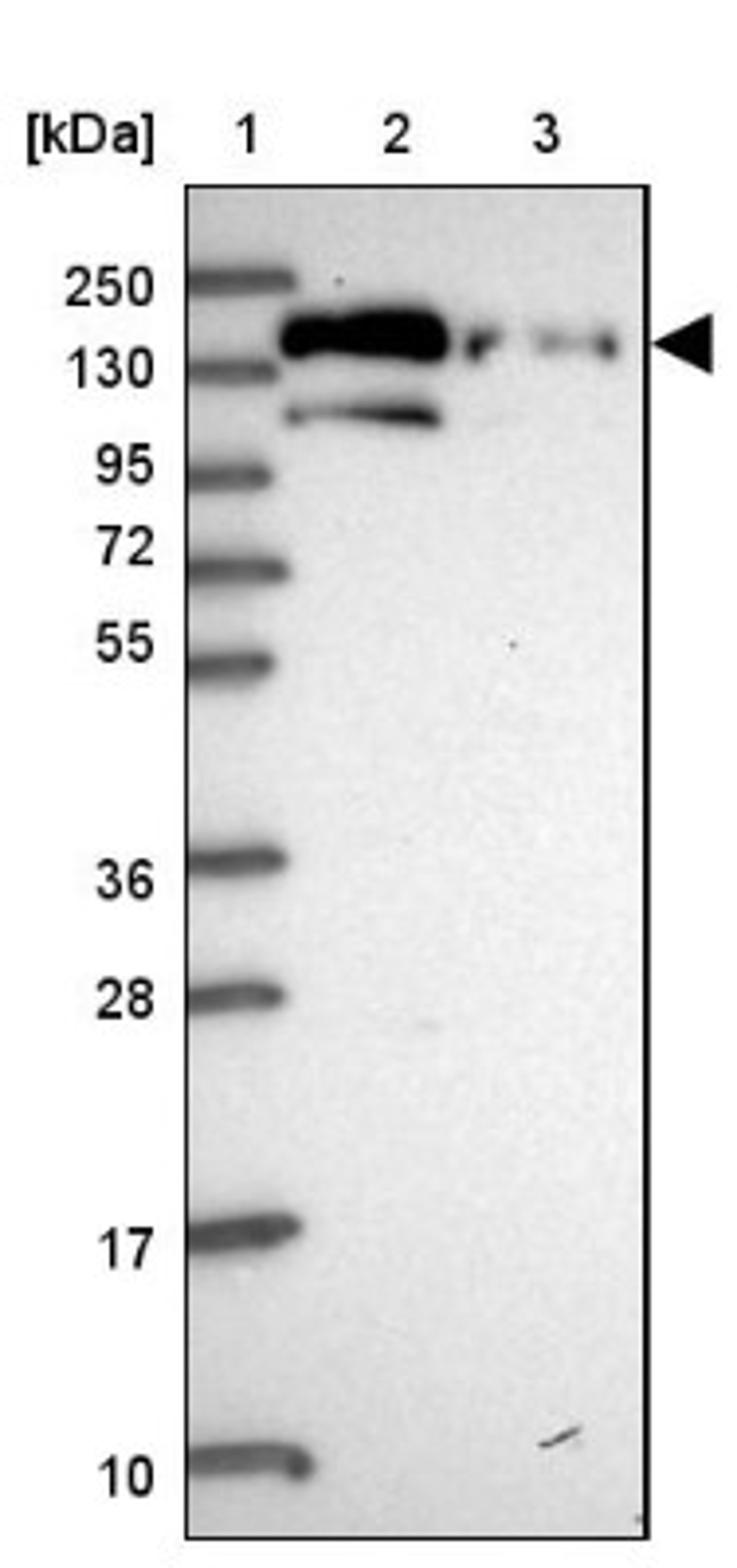 Western Blot: Phospholipase C beta 3 Antibody [NBP2-32026] - Lane 1: Marker [kDa] 250, 130, 95, 72, 55, 36, 28, 17, 10<br/>Lane 2: Human cell line RT-4<br/>Lane 3: Human cell line U-251MG sp