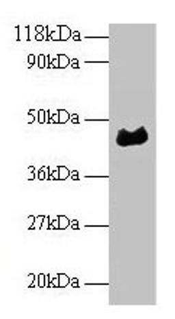 Western blot. All lanes: α1-acidglycoprotein antibody at 2µg/ml + Human serum at 1: 50. Secondary. Goat polyclonal to rabbit IgG at 1/10000 dilution. Predicted band size: 45 kDa. Observed band size: 45 kDa