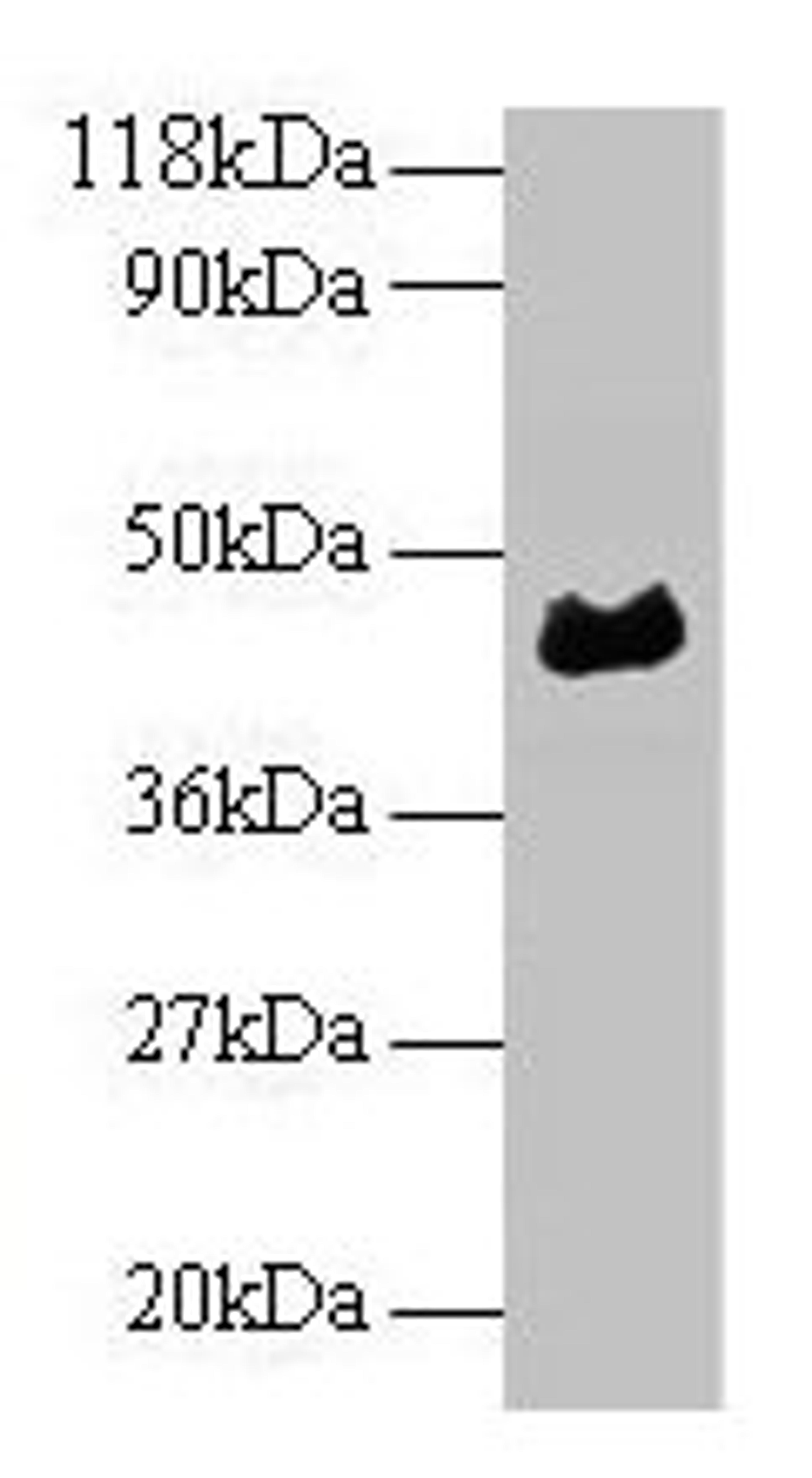 Western blot. All lanes: α1-acidglycoprotein antibody at 2µg/ml + Human serum at 1: 50. Secondary. Goat polyclonal to rabbit IgG at 1/10000 dilution. Predicted band size: 45 kDa. Observed band size: 45 kDa