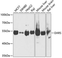 Western blot - DARS Antibody (A6574)