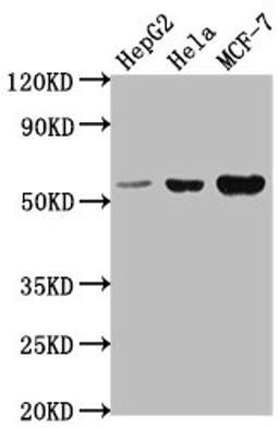 Western Blot. Positive WB detected in: HepG2 whole cell lysate, Hela whole cell lysate, MCF-7 whole cell lysate. All lanes: PRAMEF18 antibody at 1:2000. Secondary. Goat polyclonal to rabbit IgG at 1/50000 dilution. Predicted band size: 56 kDa. Observed band size: 56 kDa. 