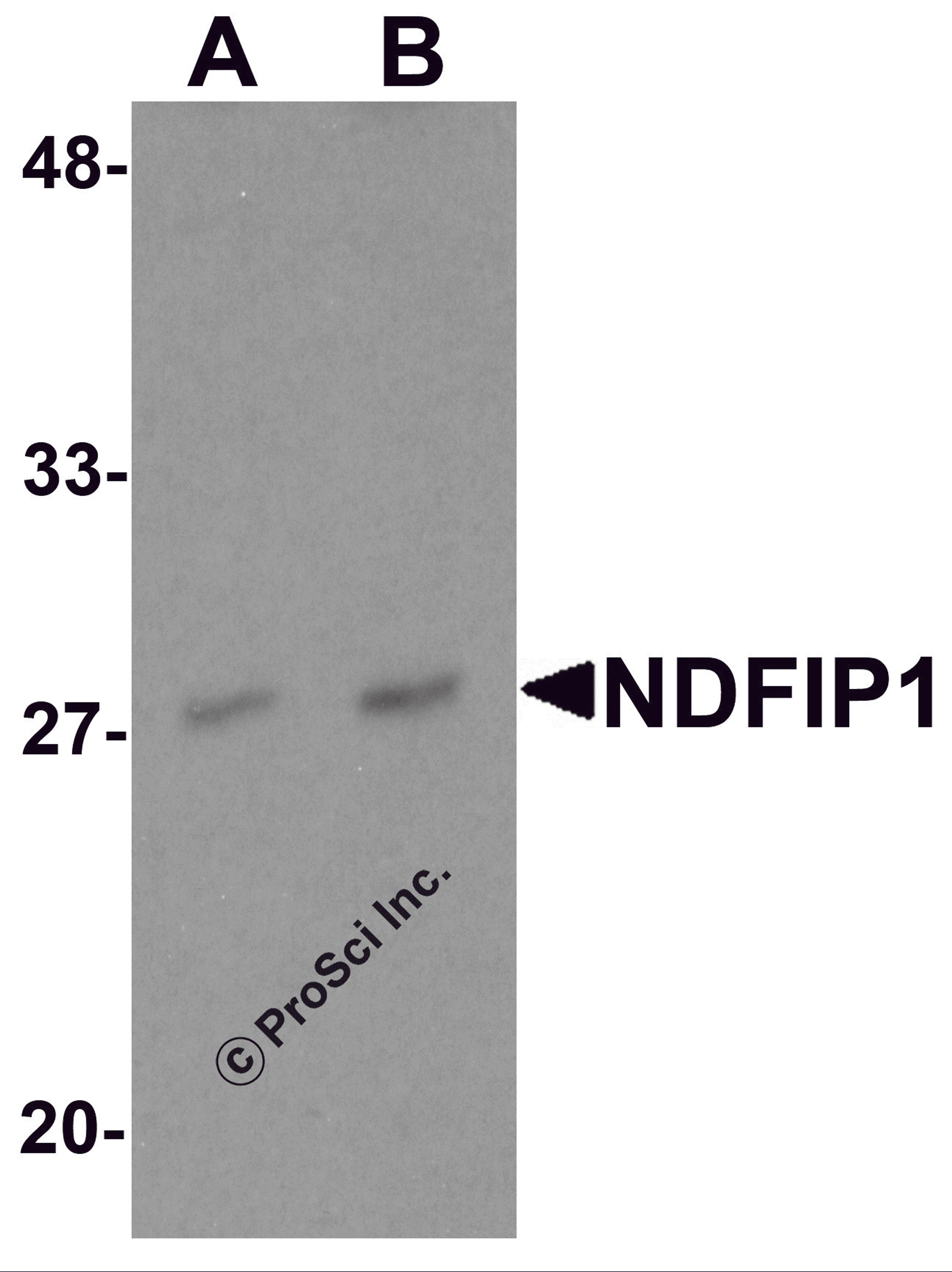 Western blot analysis of NDFIP1 in PC-3 cell lysate with NDFIP1 antibody at (A) 0.5 and (B) 1 &#956;g/mL.