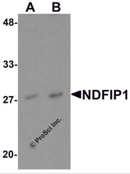 Western blot analysis of NDFIP1 in PC-3 cell lysate with NDFIP1 antibody at (A) 0.5 and (B) 1 μg/mL.