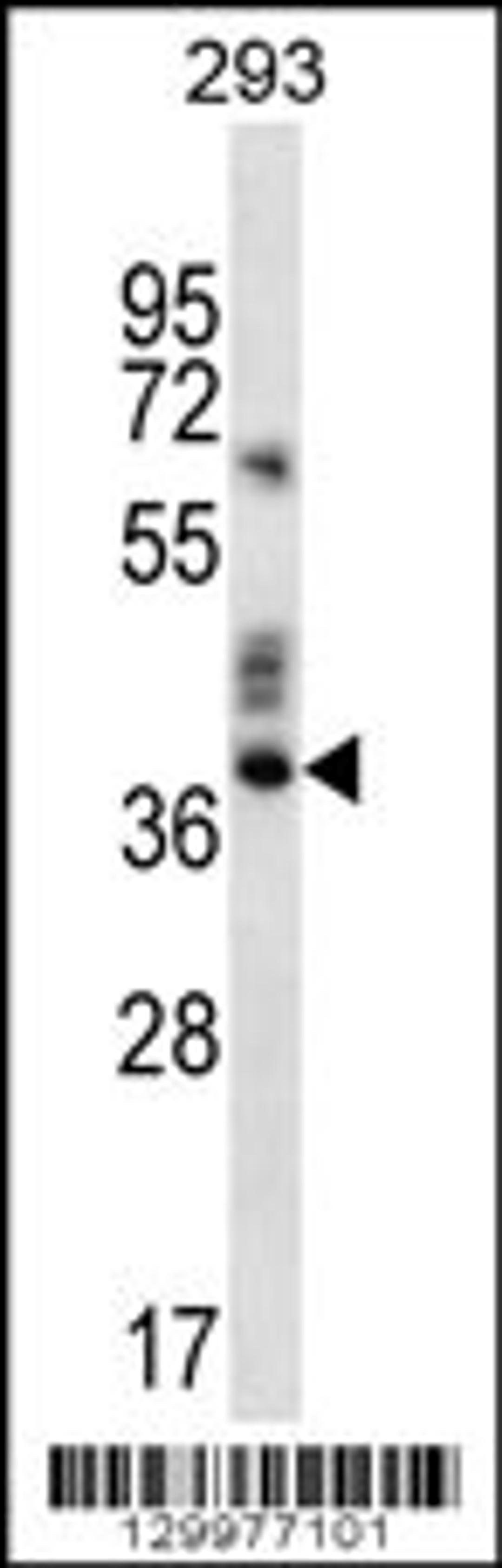 Western blot analysis in 293 cell line lysates (35ug/lane).