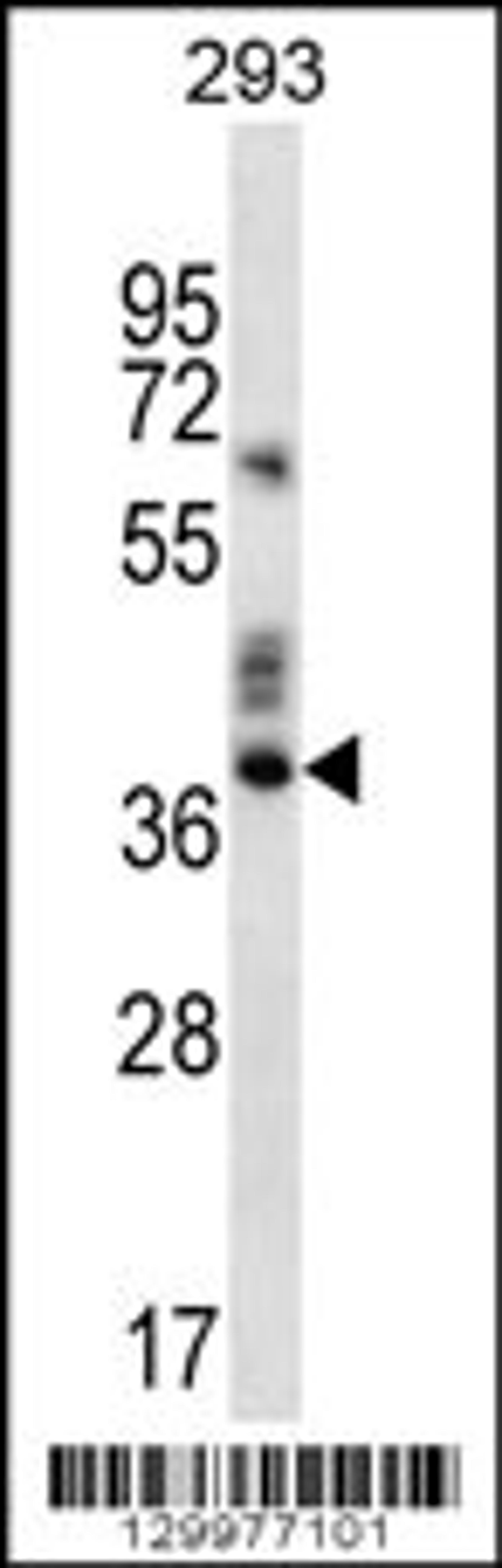 Western blot analysis in 293 cell line lysates (35ug/lane).