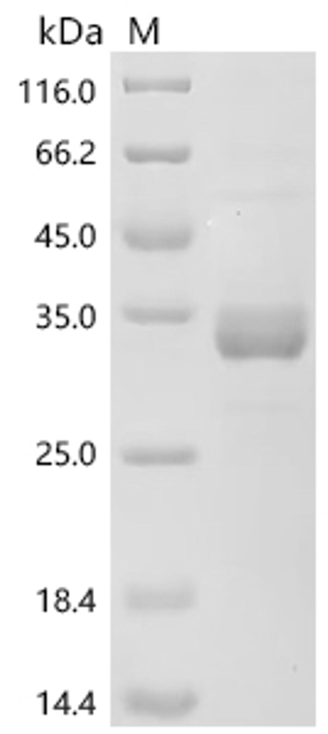 (Tris-Glycine gel) Discontinuous SDS-PAGE (reduced) with 5% enrichment gel and 15% separation gel.
