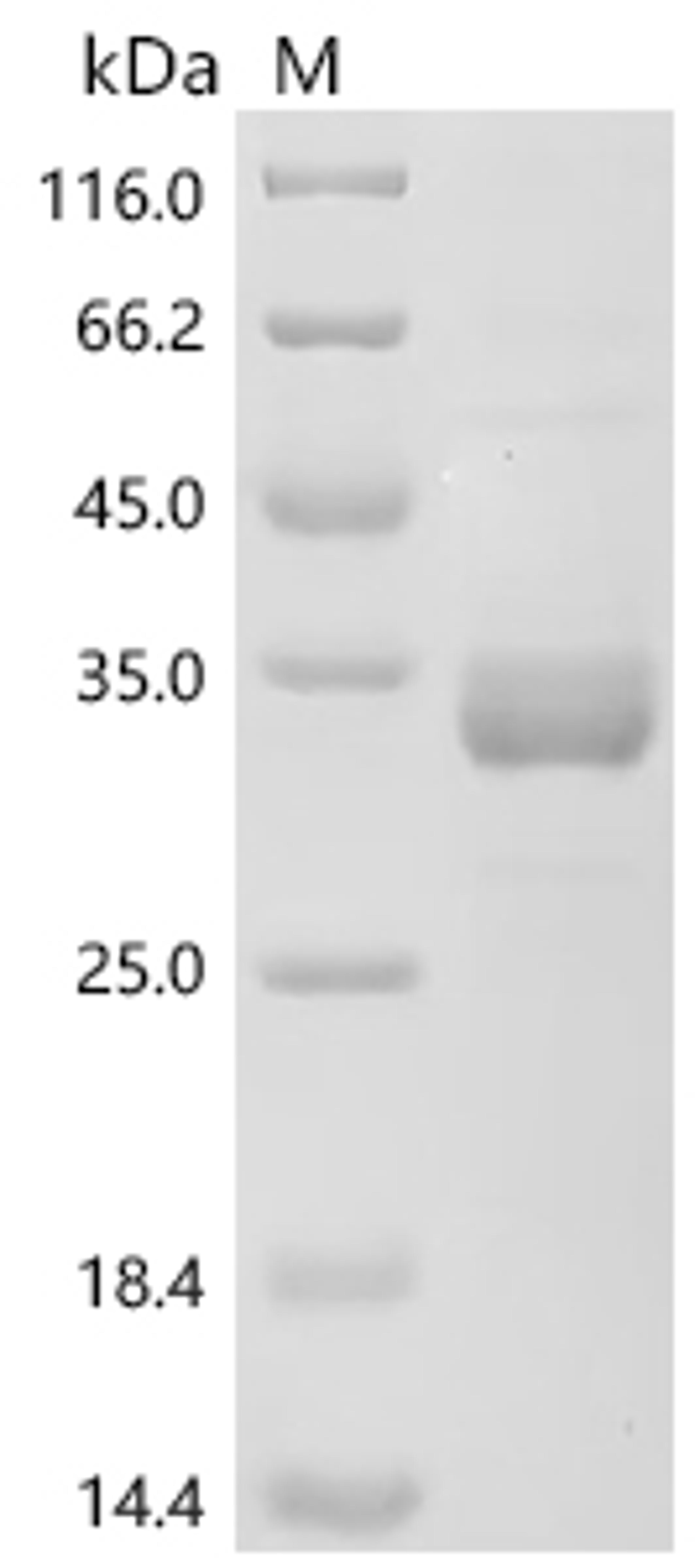 (Tris-Glycine gel) Discontinuous SDS-PAGE (reduced) with 5% enrichment gel and 15% separation gel.