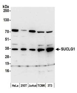 Detection of human and mouse SUCLG1 by western blot.