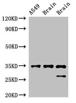 Western Blot. Positive WB detected in: A549 whole cell lysate, Rat brain tissue, Mouse brain tissue. All lanes: STUB1 antibody at 2ug/ml. Secondary. Goat polyclonal to rabbit IgG at 1/50000 dilution. Predicted band size: 35, 28 kDa. Observed band size: 35, 28 kDa. 