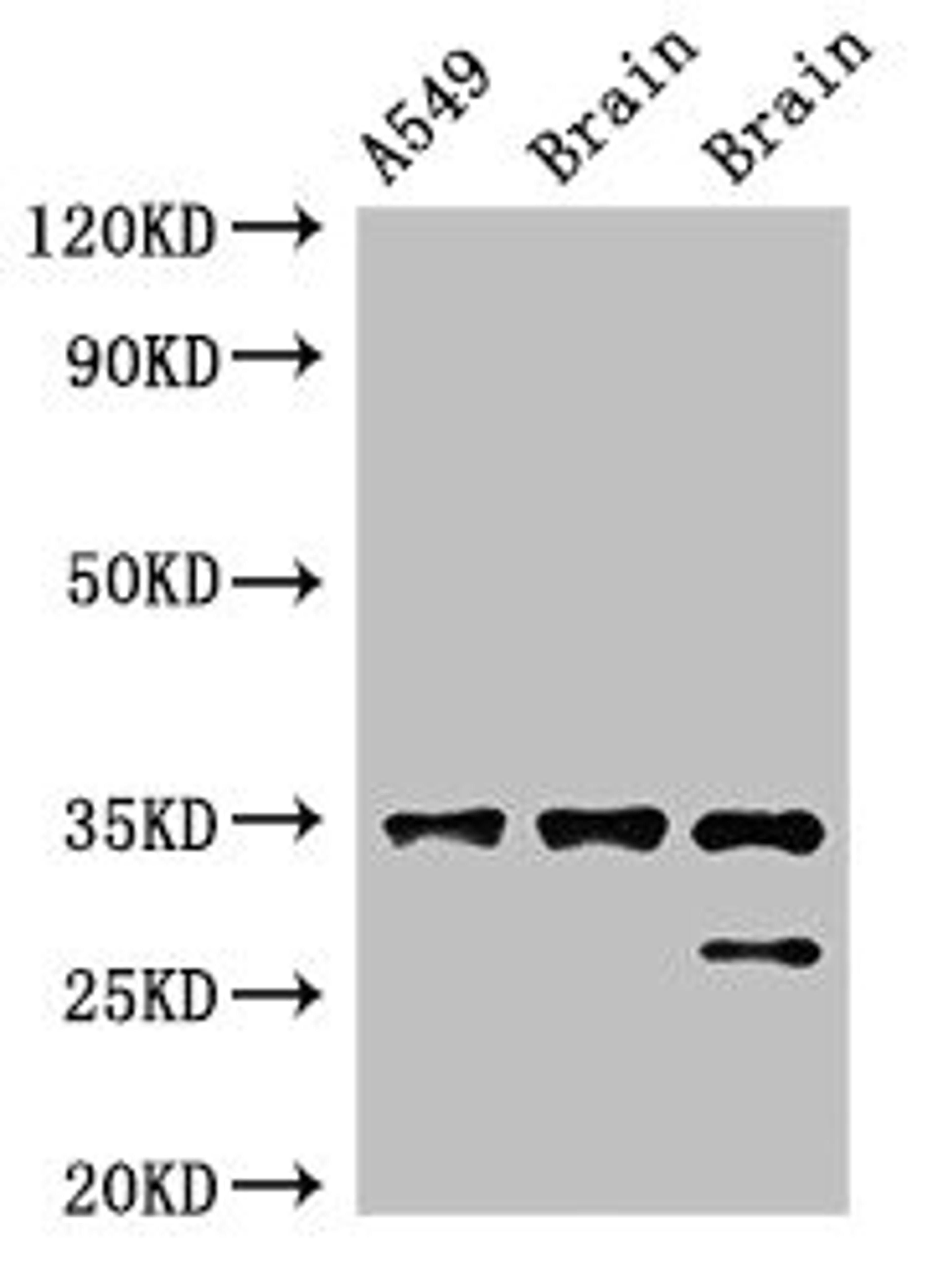 Western Blot. Positive WB detected in: A549 whole cell lysate, Rat brain tissue, Mouse brain tissue. All lanes: STUB1 antibody at 2ug/ml. Secondary. Goat polyclonal to rabbit IgG at 1/50000 dilution. Predicted band size: 35, 28 kDa. Observed band size: 35, 28 kDa. 