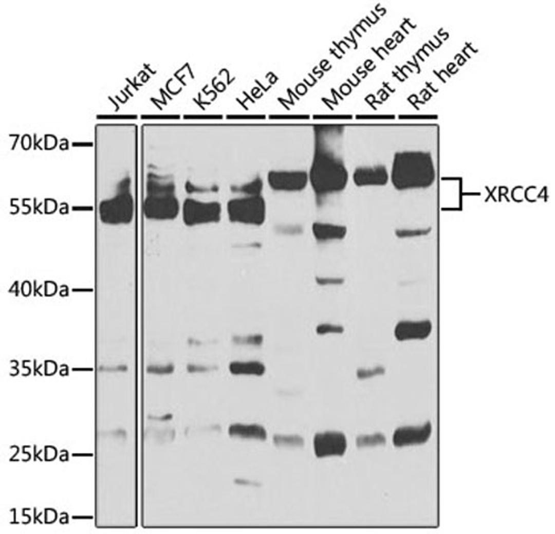 Western blot - XRCC4 antibody (A1677)