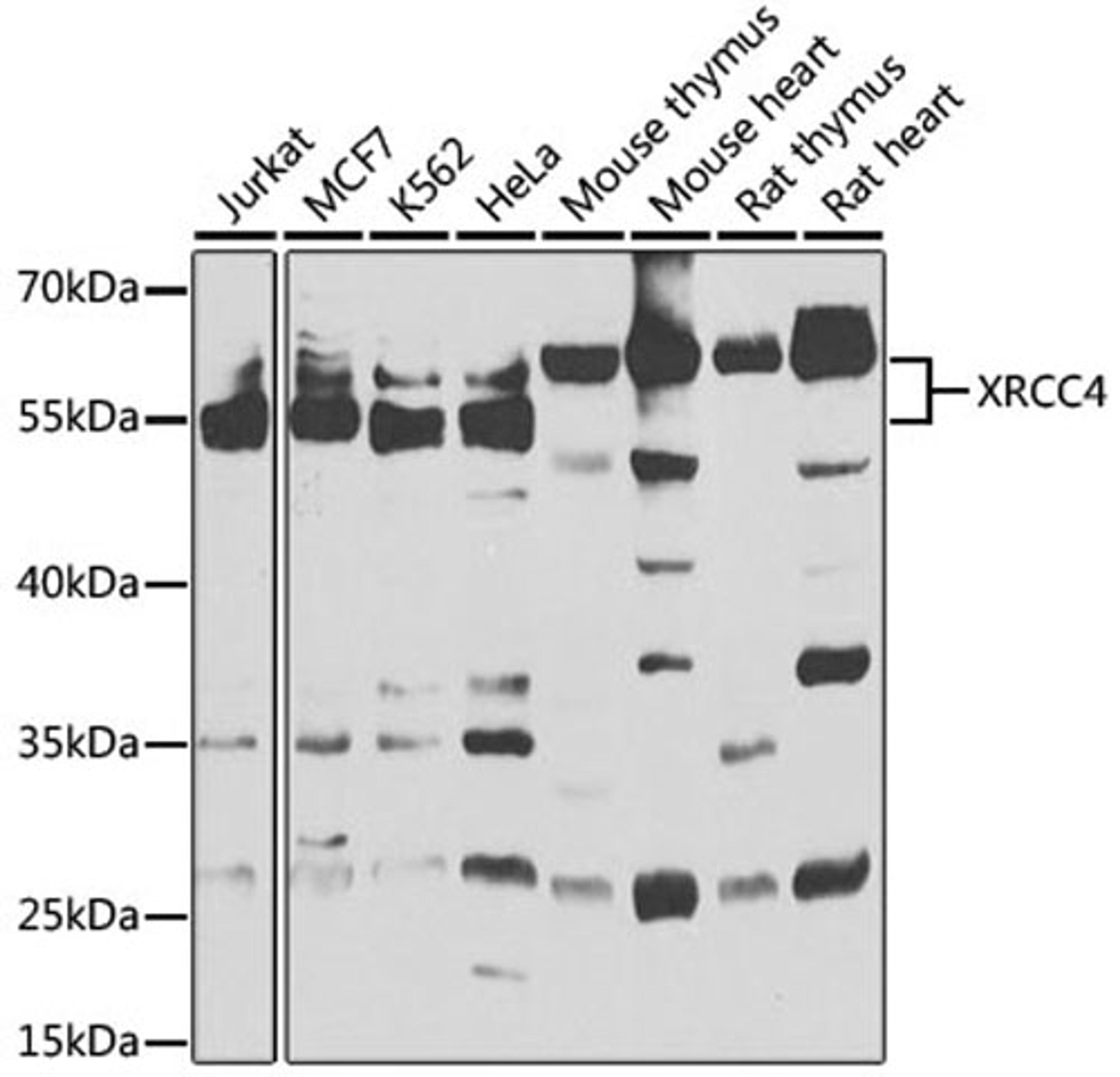 Western blot - XRCC4 antibody (A1677)