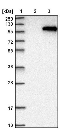 Western Blot: PDE6A Antibody [NBP1-87312] - Lane 1: Marker [kDa] 250, 130, 95, 72, 55, 36, 28, 17, 10<br/>Lane 2: Negative control (vector only transfected HEK293T lysate)<br/>Lane 3: Over-expression lysate (Co-expressed with a C-terminal myc-DDK tag (~3.1 kDa) in mammalian HEK293T cells, LY424714)