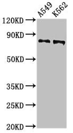 Western Blot. Positive WB detected in: A549 whole cell lysat, K562 whole cell lysate. All lanes: CAPN1 antibody at 2.7µg/ml. Secondary. Goat polyclonal to rabbit IgG at 1/50000 dilution. Predicted band size: 82 kDa. Observed band size: 82 kDa