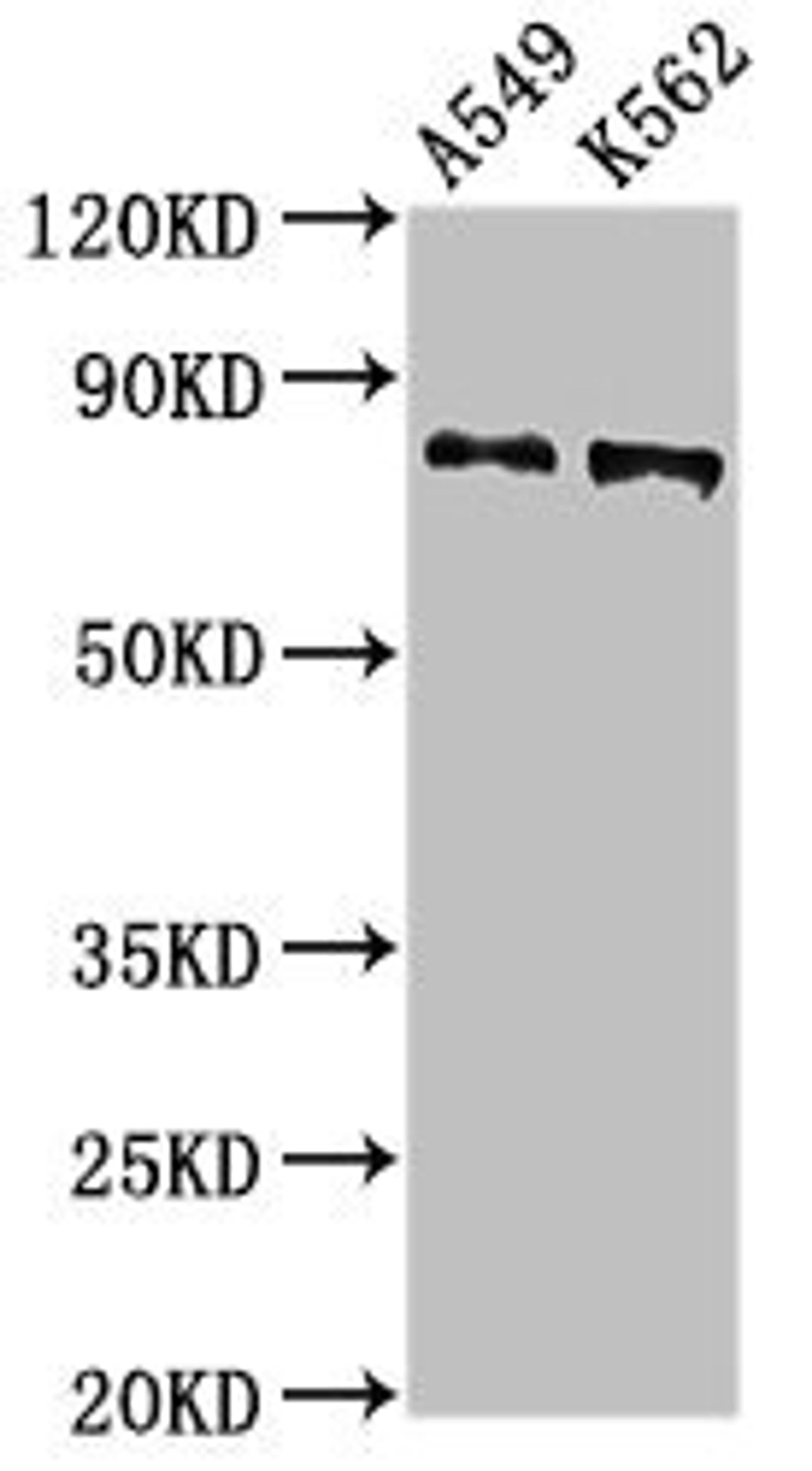 Western Blot. Positive WB detected in: A549 whole cell lysat, K562 whole cell lysate. All lanes: CAPN1 antibody at 2.7µg/ml. Secondary. Goat polyclonal to rabbit IgG at 1/50000 dilution. Predicted band size: 82 kDa. Observed band size: 82 kDa