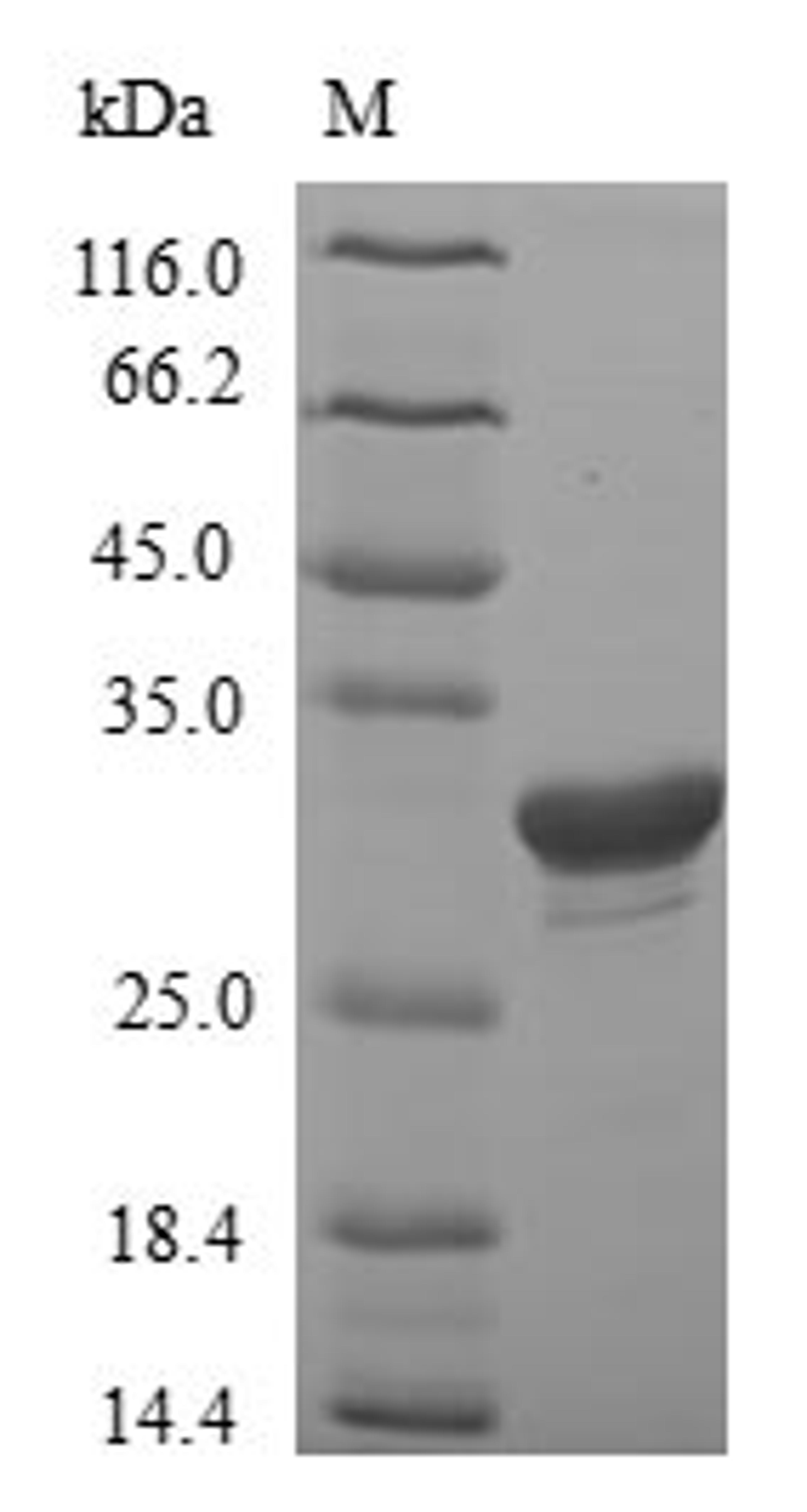 (Tris-Glycine gel) Discontinuous SDS-PAGE (reduced) with 5% enrichment gel and 15% separation gel.
