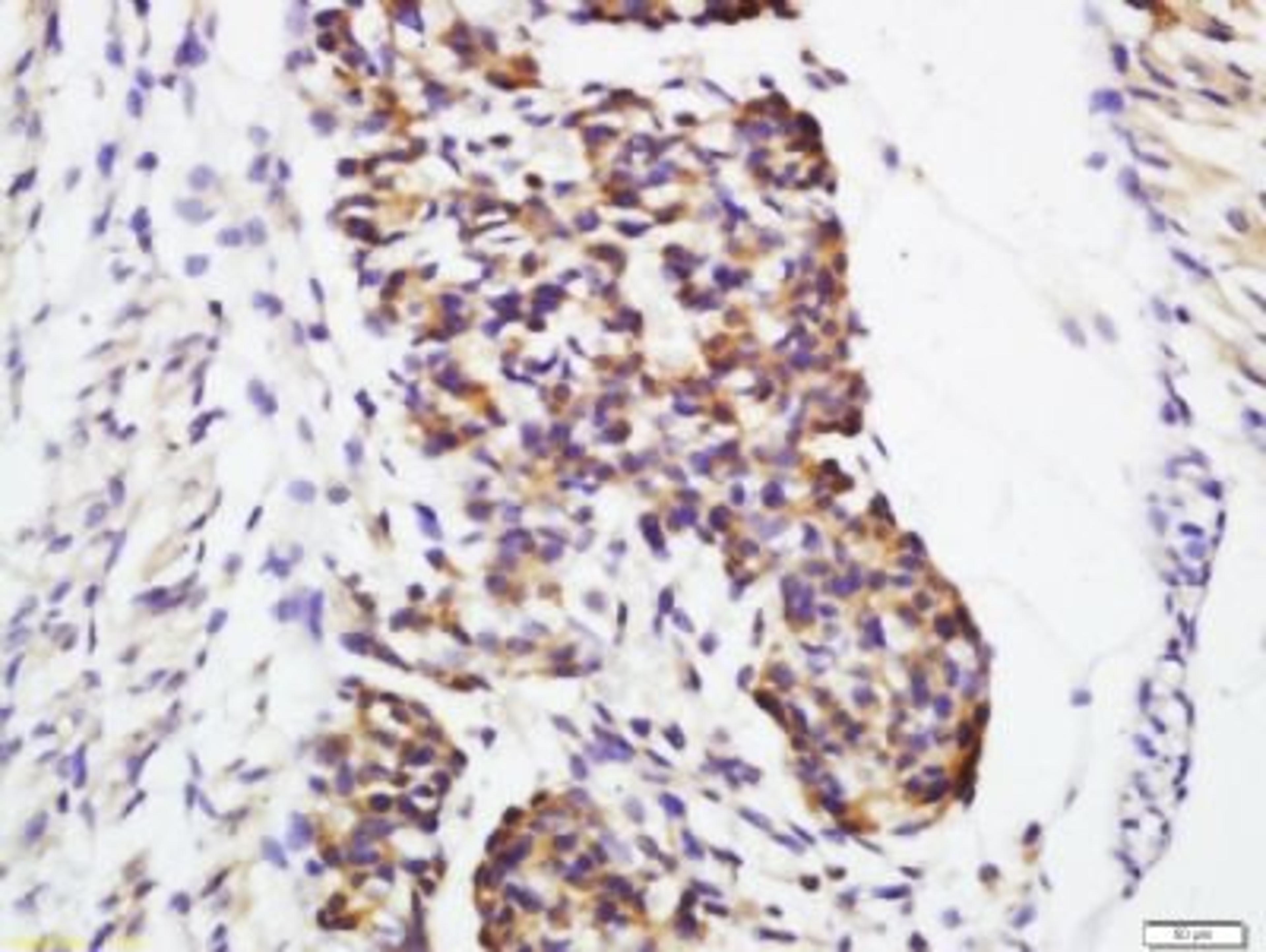 Immunohistochemical staining of mouse embryo tissue using Galectin 1 antibody.