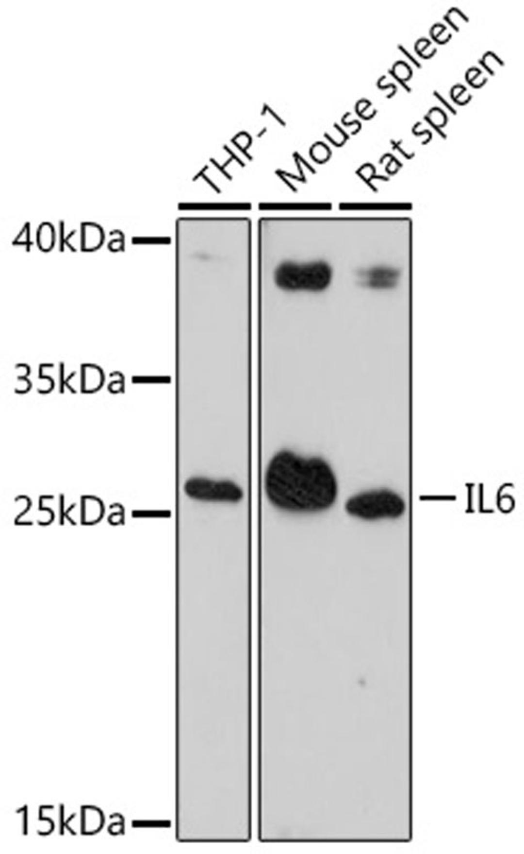 Western blot - IL6 antibody (A14687)