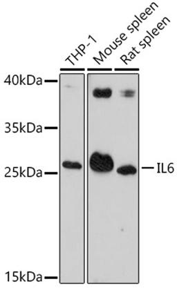 Western blot - IL6 antibody (A14687)