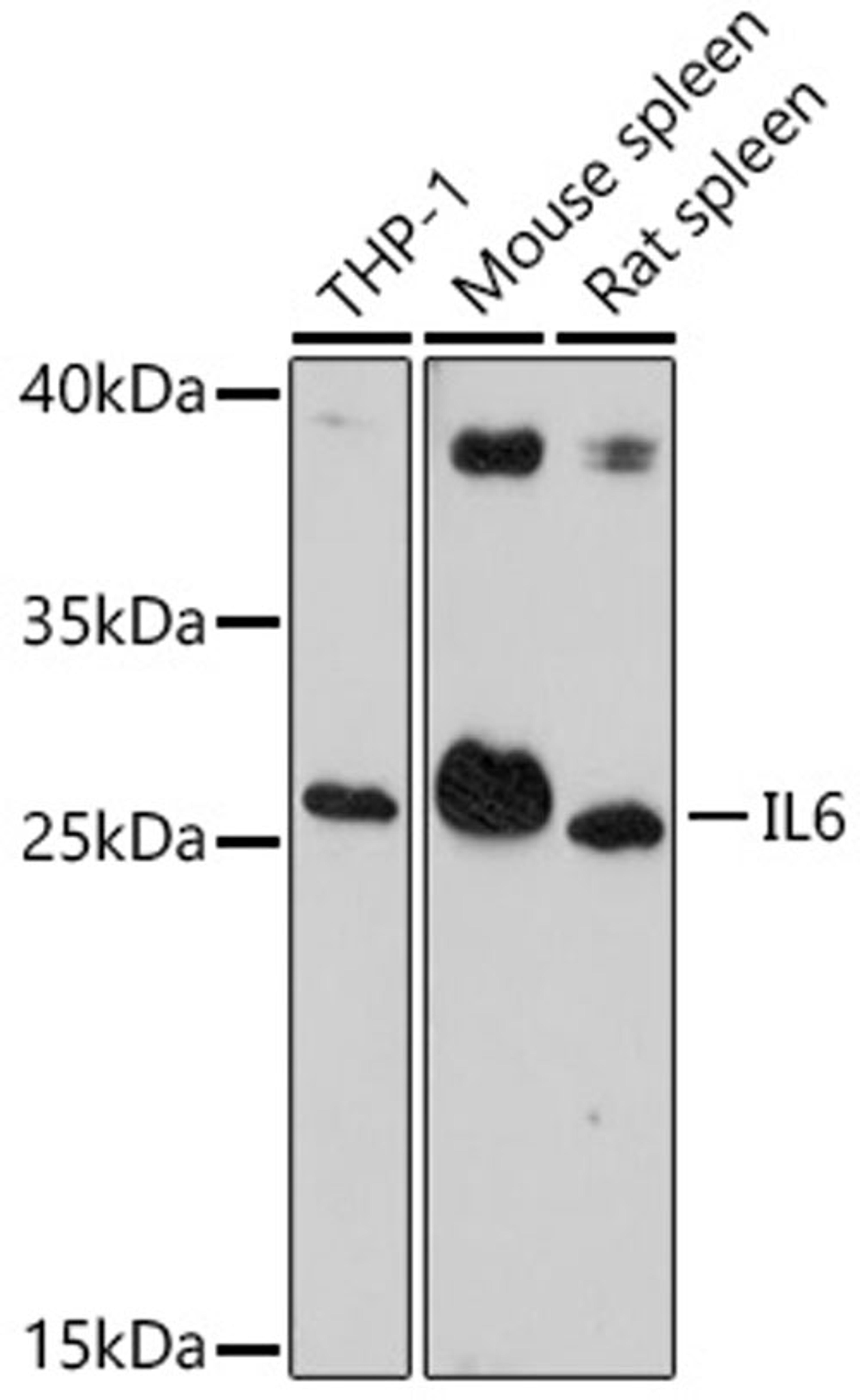 Western blot - IL6 antibody (A14687)