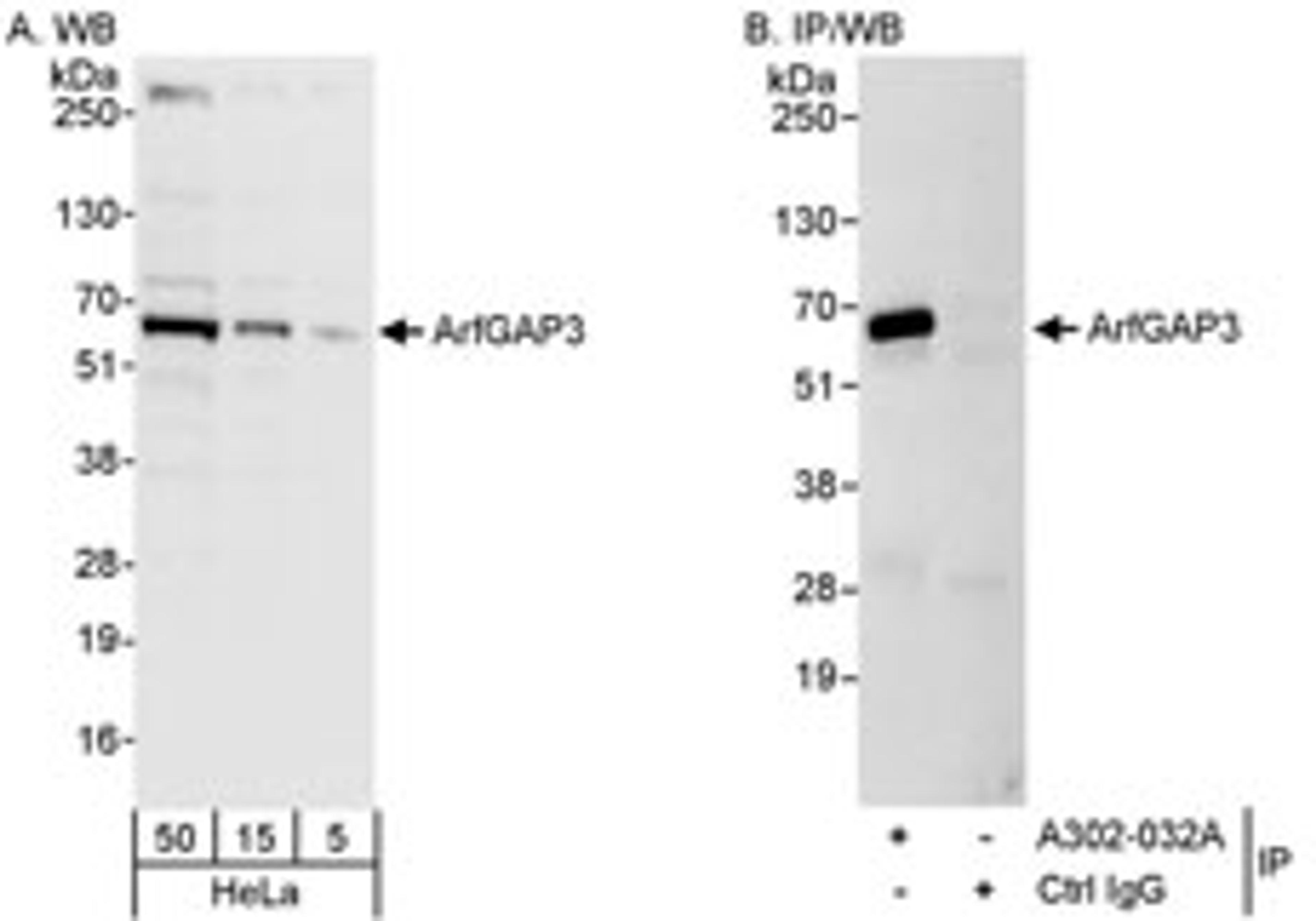 Detection of human ArfGAP3 by western blot and immunoprecipitation.