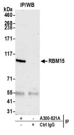 Detection of human RBM15 by western blot of immunoprecipitates.