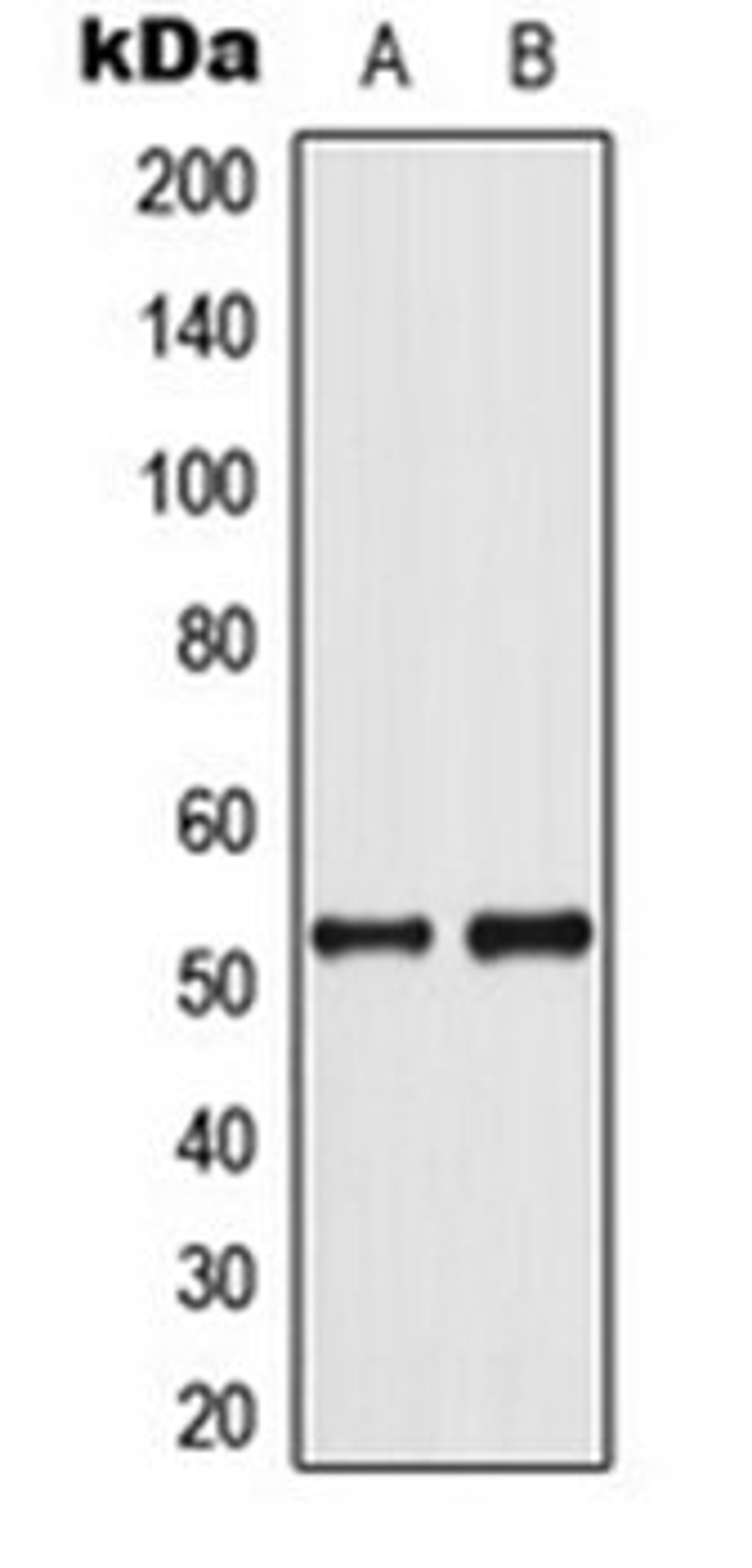 Western blot analysis of COLO205 (Lane 1), Jurkat UV-treated (Lane 2) whole cell lysates using p53 (phospho-S37) antibody