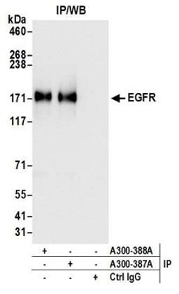 Detection of human EGFR by western blot of immunoprecipitates.