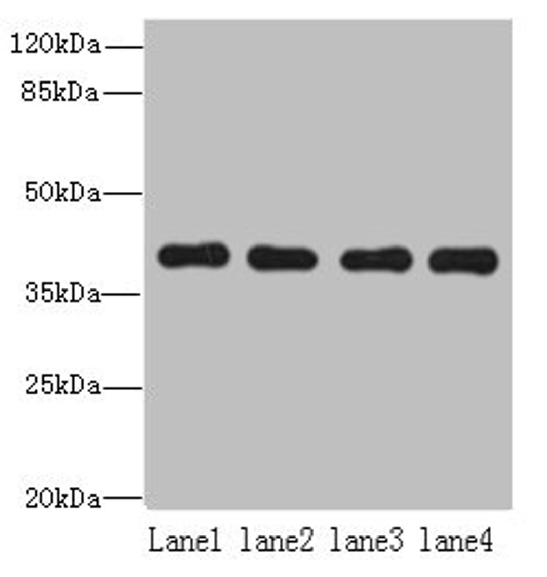 Western blot. All lanes: NUDT9 antibody at 8ug/ml. Lane 1: Raji whole cell lysate. Lane 2: Jurkat whole cell lysate. Lane 3: Mouse kidney tissue. Lane 4: Hela whole cell lysate. Secondary. Goat polyclonal to rabbit IgG at 1/10000 dilution. Predicted band size: 40, 34 kDa. Observed band size: 40 kDa.