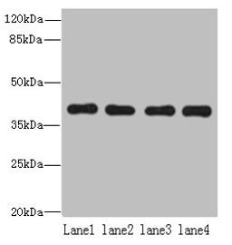 Western blot. All lanes: NUDT9 antibody at 8ug/ml. Lane 1: Raji whole cell lysate. Lane 2: Jurkat whole cell lysate. Lane 3: Mouse kidney tissue. Lane 4: Hela whole cell lysate. Secondary. Goat polyclonal to rabbit IgG at 1/10000 dilution. Predicted band size: 40, 34 kDa. Observed band size: 40 kDa.