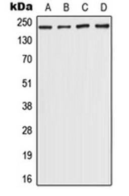 Western blot analysis of Hela (Lane 1), HepG2 (Lane 2), NIH3T3 (Lane 3), rat brain (Lane 4) whole cell lysates using CHD5 antibody