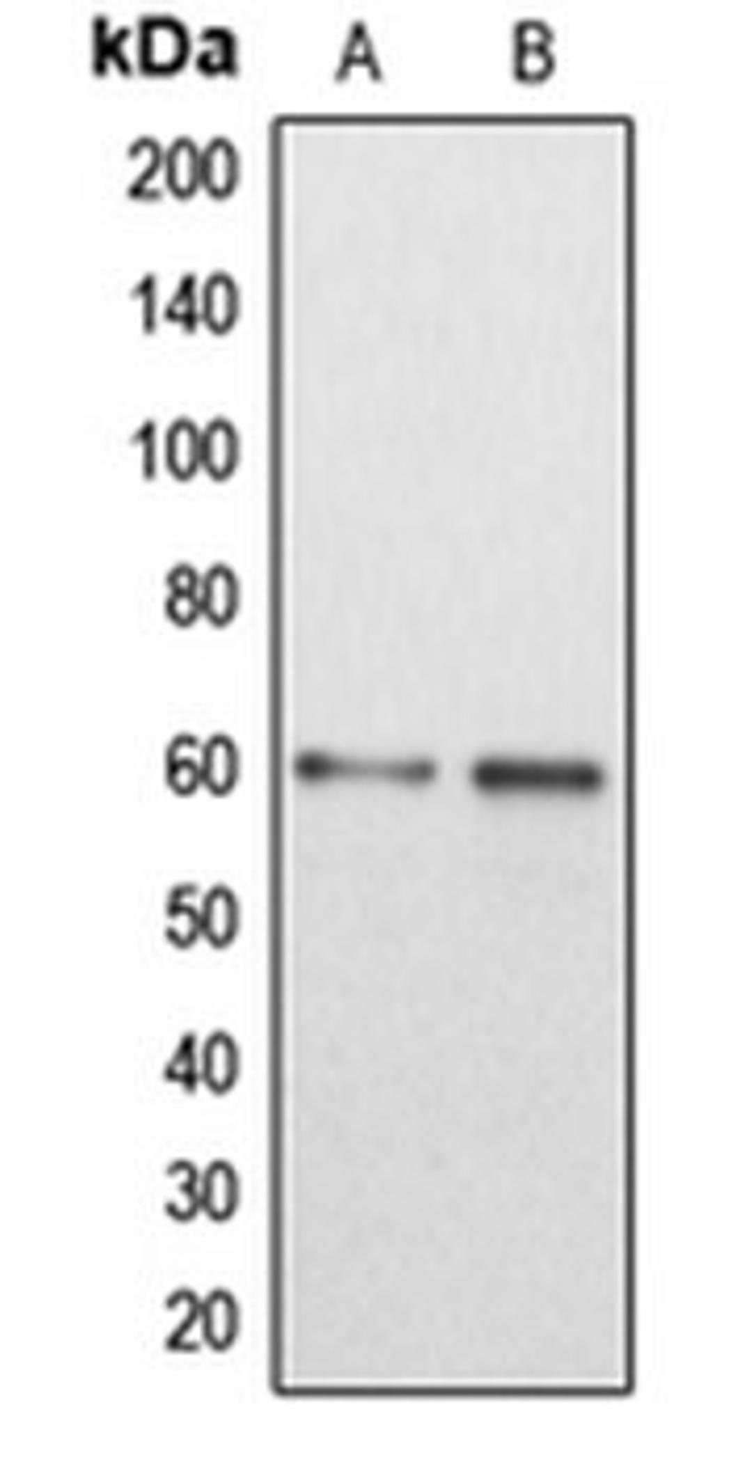 Western blot analysis of MCF7 (Lane 1), HEK293T (Lane 2) whole cell lysates using DAB1 antibody