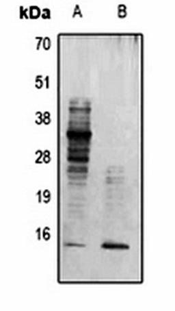 Western blot analysis of mouse brain (Lane 1), Hela TSA-treated (Lane 2) whole cell lysates using Acetyl Lysine antibody