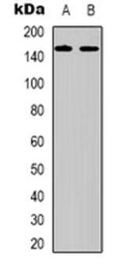 Western blot analysis of Laminin gamma 2 expression in A431 (Lane 1), Raji (Lane 2) whole cell lysates using LAMC2 antibody