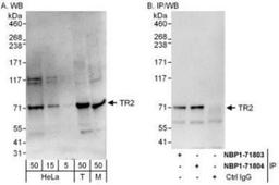 Western Blot: NR2C1 Antibody [NBP1-71803] - Whole cell lysate from HeLa (H; 50 mcg for WB; 1 mg for IP, 20% of IP loaded), 293T (5, 15, and 50 mcg for WB) and mouse NIH3T3 (M; 50 mcg) cells.  Affinity purified rabbit anti-TR2 antibody used for WB at 0.1 mcg/ml (A) and 0.4 mcg/ml (B) and used for IP at 6 mcg/mg lysate.  TR2 was also immunoprecipitated by rabbit anti-TR2 antibody NBP1-71804, which recognizes a downstream epitope.