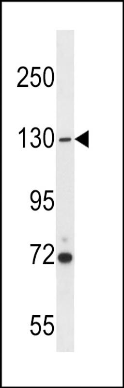 Western blot analysis in A2058 cell line lysates (35ug/lane).