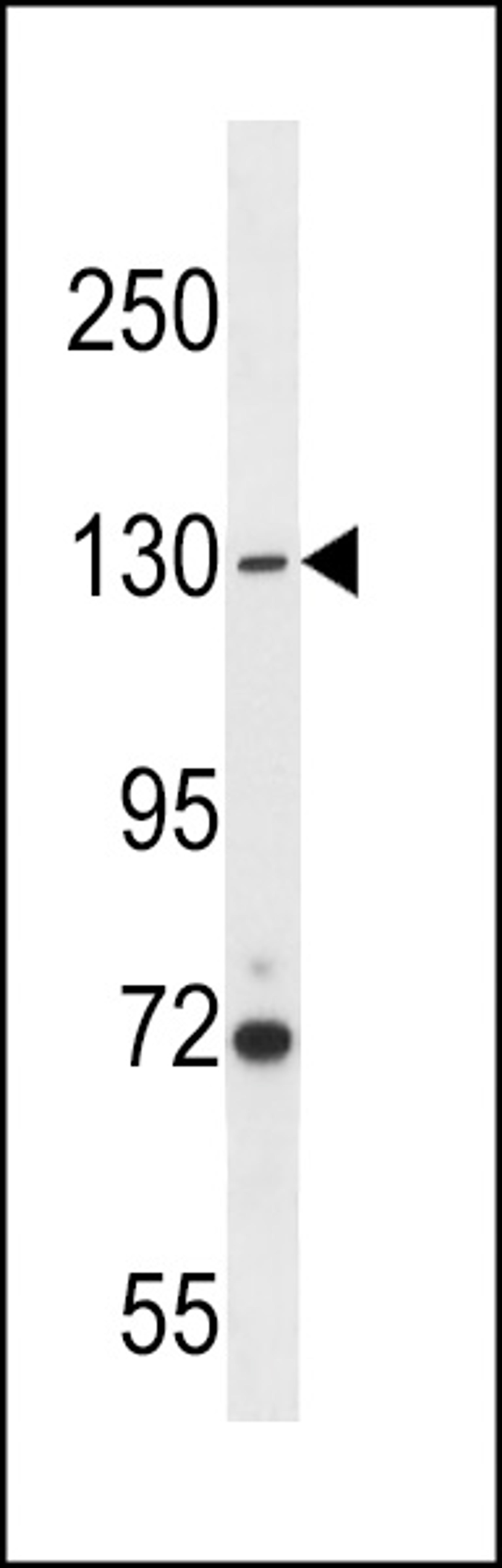 Western blot analysis in A2058 cell line lysates (35ug/lane).